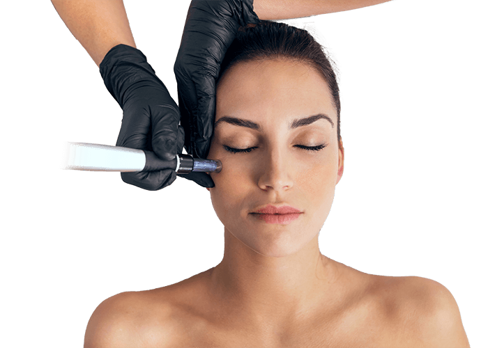 Portrait einer Frau während einer Behandlung mit Microneedling